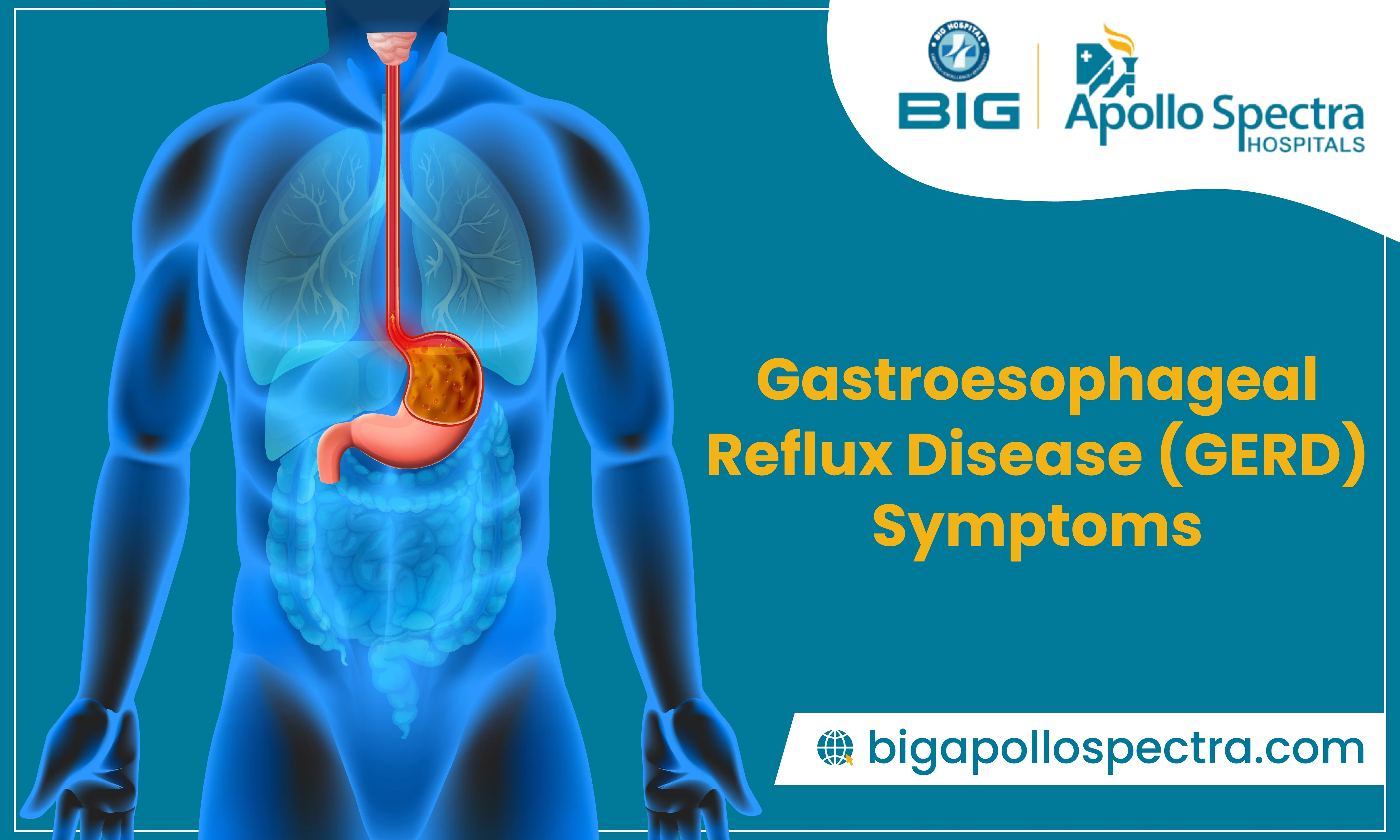 Understanding and Managing Gastroesophageal Reflux Disease (GERD): From Lifestyle Changes to Advanced Therapies