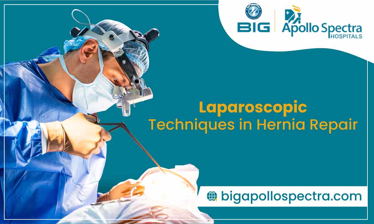 Laparoscopic Techniques in Hernia Repair