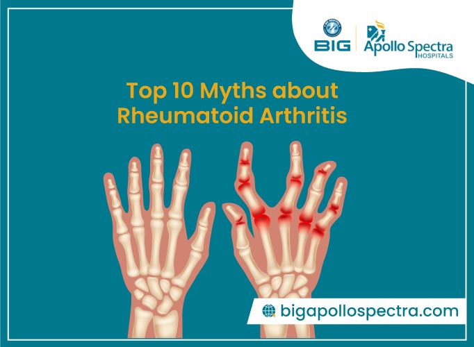 Causes, Symptoms, Treatment & Top 10 Myths about Rheumatoid Arthritis
