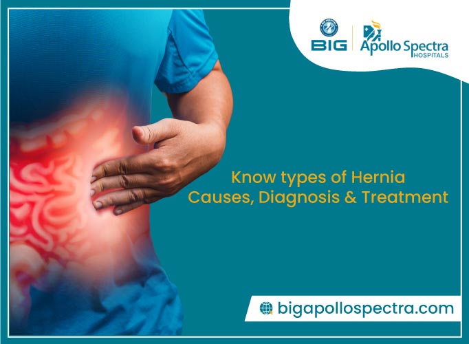 Hernia - Types, Causes, Diagnosis & Treatments