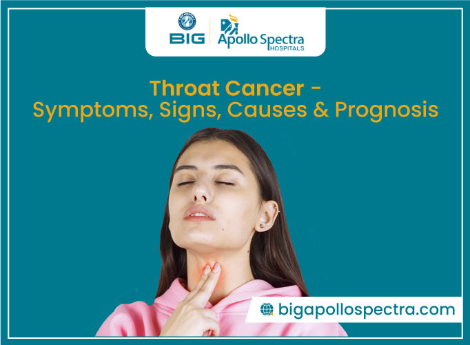 Throat Cancer: Symptoms, Signs, Causes & Prognosis