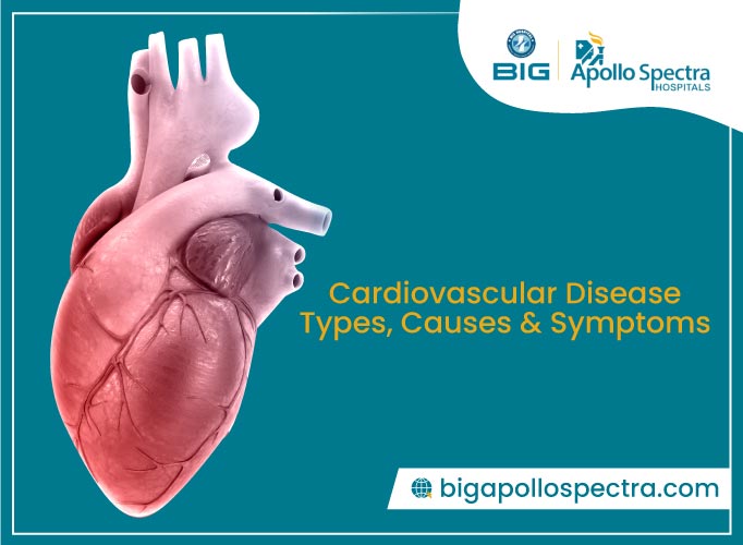 Cardiovascular Disease - Types, Causes and Symptoms