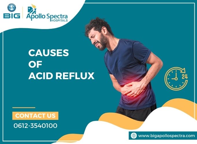 Causes of Acid Reflux – How to Prevent Heartburn & its Symptoms