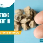 Kidney stone treatment in Patna