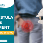 Piles Fistula Fissure Treatment