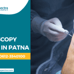 Knee Arthroscopy Surgery in Patna