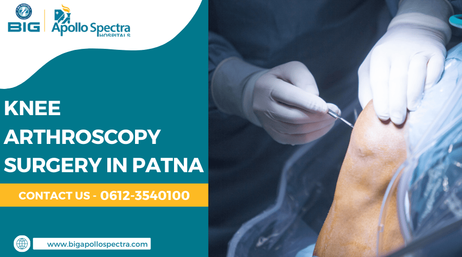 Knee Arthroscopy Surgery in Patna
