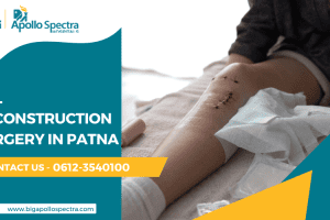 ACL Reconstruction Surgery in Patna