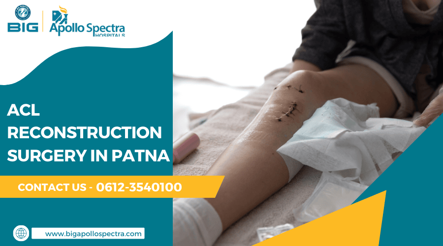 ACL Reconstruction Surgery in Patna – Cost & Patient Reviews