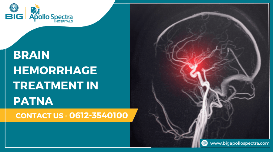 Cost of Brain Hemorrhage Treatment In Patna W/ Recovery Tips