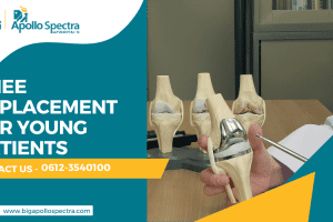Knee Replacement for Young Patients