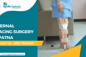 Internal Bracing Surgery In Patna