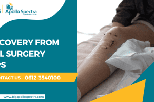 Recovery from ACL Surgery Tips