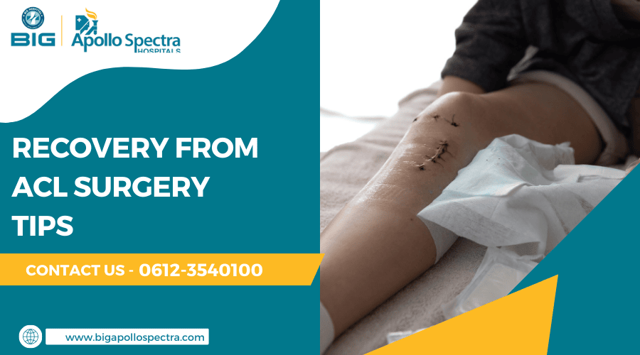 Recovery from ACL Surgery Tips