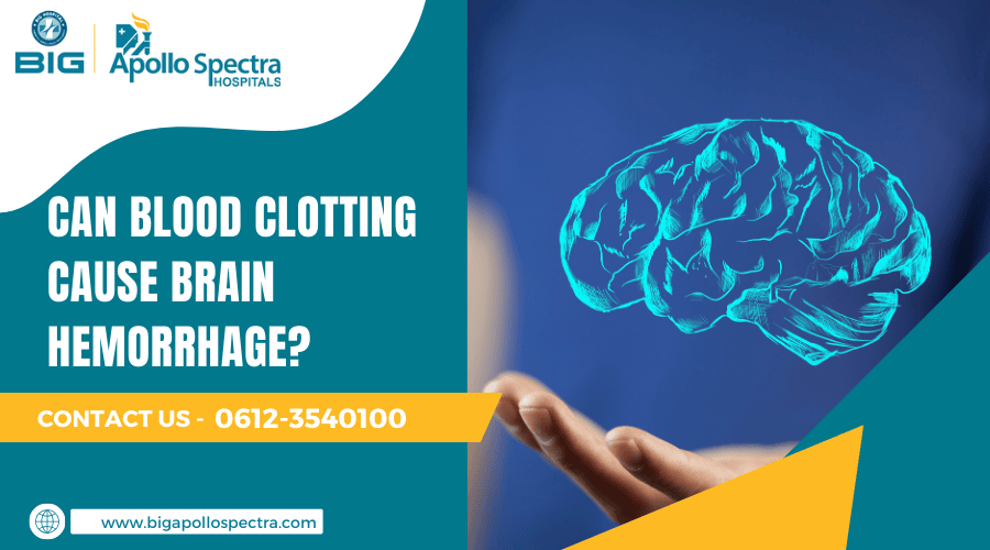 Can Blood Clotting Cause Brain Hemorrhage