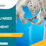 Signs You Need Joint Replacement Surgery