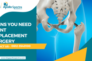 Signs You Need Joint Replacement Surgery
