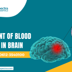 Treatment of Blood Clotting in Brain