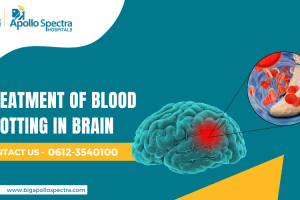 Treatment of Blood Clotting in Brain