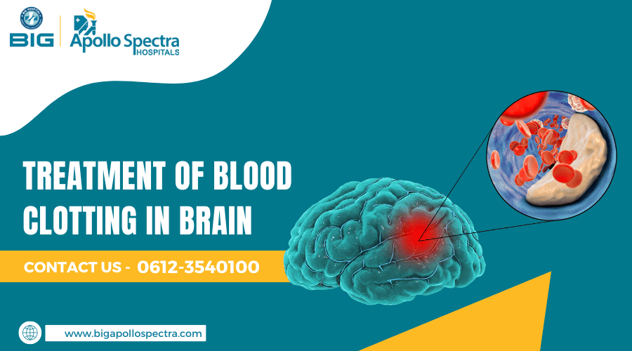 Treatment of Blood Clotting in Brain