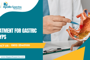 Treatment for Gastric Polyps