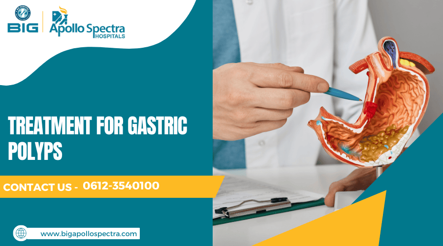 Treatment for Gastric Polyps