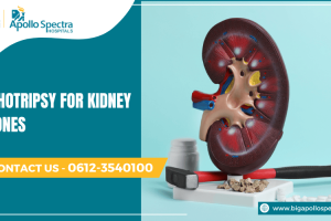 Lithotripsy for Kidney Stones