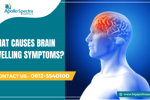 What Causes Brain Swelling Symptoms