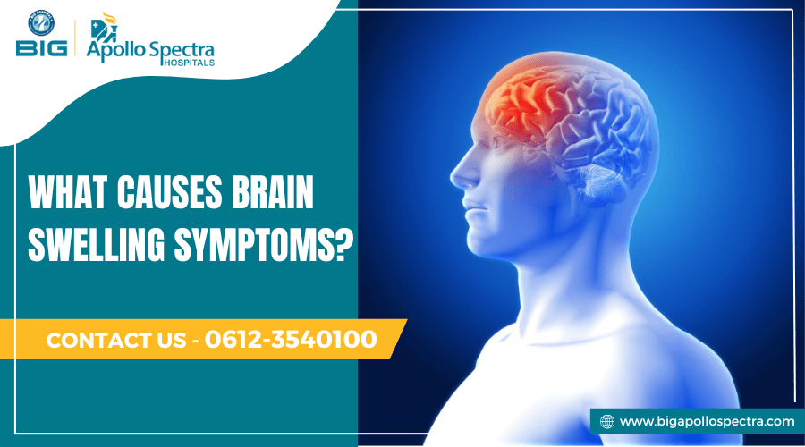 What Causes Brain Swelling Symptoms