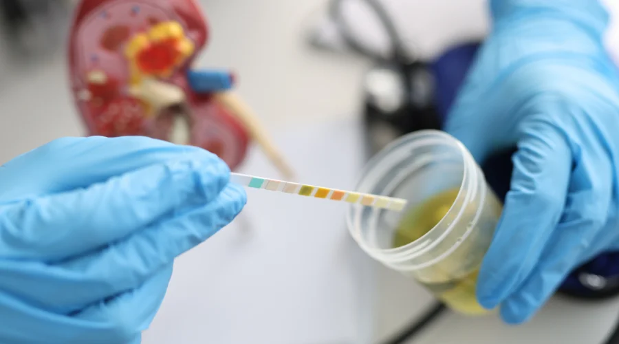 urine sample