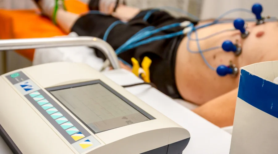 ECG test