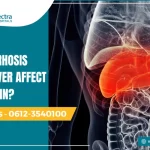 does cirrhosis of the liver affect your brain