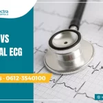 normal vs abnormal ecg