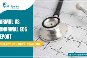 normal vs abnormal ecg