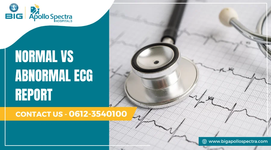 normal vs abnormal ecg