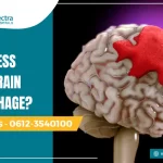 can stress cause brain hemorrhage