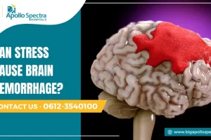 can stress cause brain hemorrhage