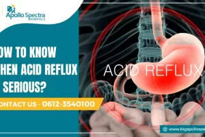 how to know when acid reflux is serious