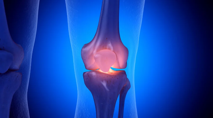 Difference between knee pain and arthritis