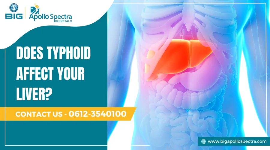 does typhoid affect liver