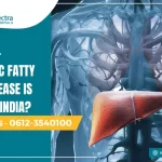 non alcoholic fatty liver disease in India