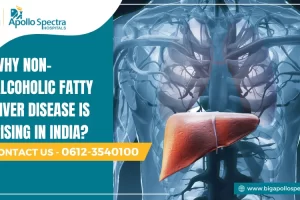 non alcoholic fatty liver disease in India
