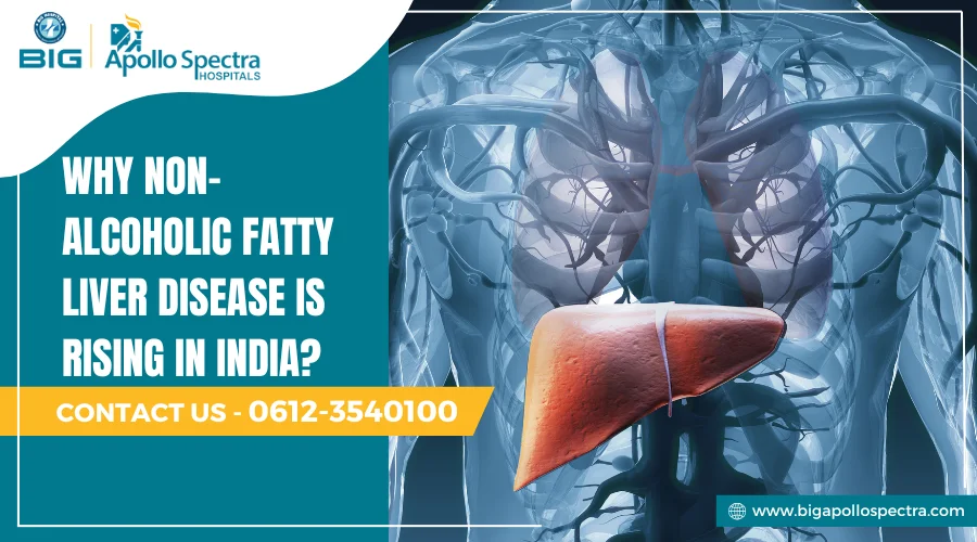 non alcoholic fatty liver disease in India