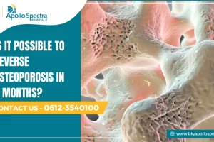 reverse osteoporosis in 6 months