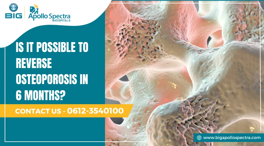reverse osteoporosis in 6 months