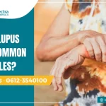 Why is lupus more common in females