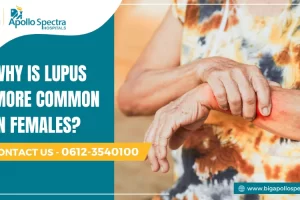 Why is lupus more common in females