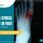 repeated stress fracture in foot