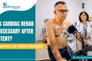 is cardiac rehab necessary after stent