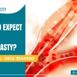 what to expect during angioplasty
